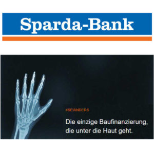 Kostenloses Chip-Implantat bei Abschluß einer Baufinanzierung bei der Sparda Bank Berlin